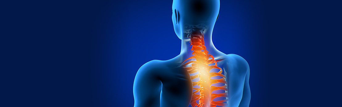 Kínzó nyakfájás: 7 módszer, ami enyhíti a fájdalmat